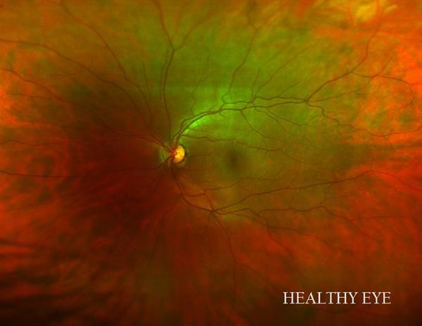Hattan and Mondero Family Eye Care gallery image 3