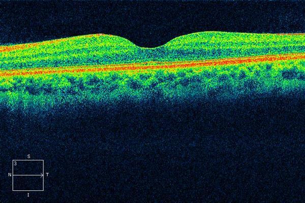 Hattan and Mondero Family Eye Care gallery image 4